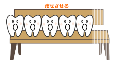 椅子は4人掛けのままで、座る5人をそれぞれ痩せさせる